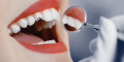 emergency dental care extractions wisdom tooth emergency dentistry Oak Hollow Dentistry dentist in Draper Utah
